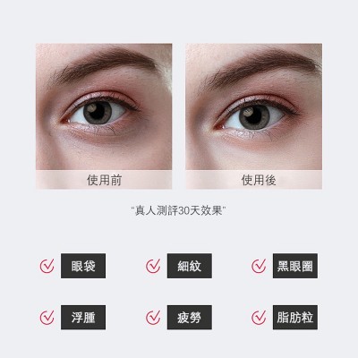 MARASIL - 射频眼部导入美容仪 (去细纹皱纹黑眼圈 提拉紧致)
